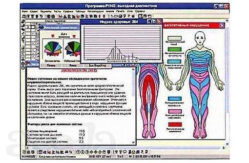 Тестирование всего организма. Биолаз-Оберон/Дианел.